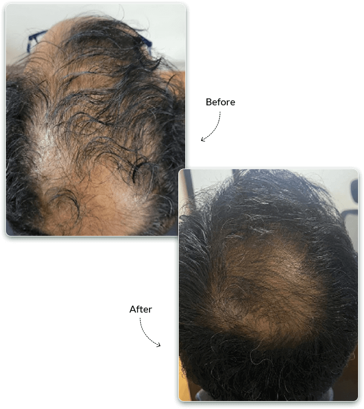 QR678 Before and After Treatment Result