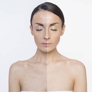 Detan Facial