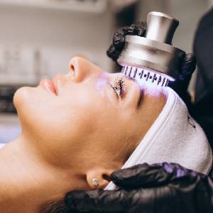 IPL Photofacial