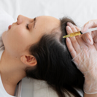 PRP Treatment