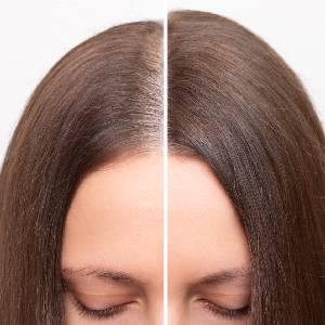 Hair Regenera Treatment
