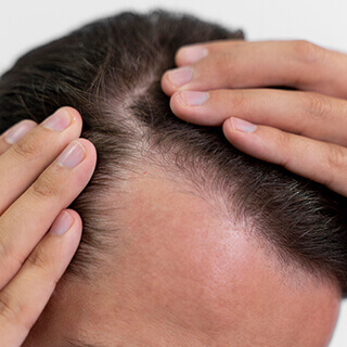 Hair Loss Treatment