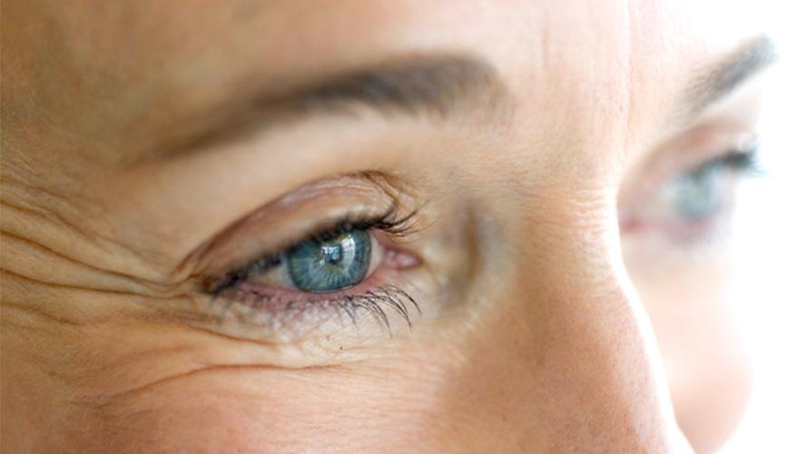 the curious case of crow feet