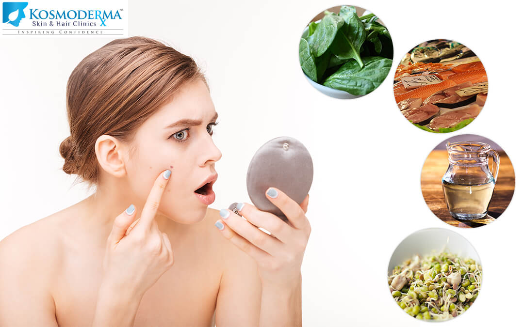 can food help prevent acne