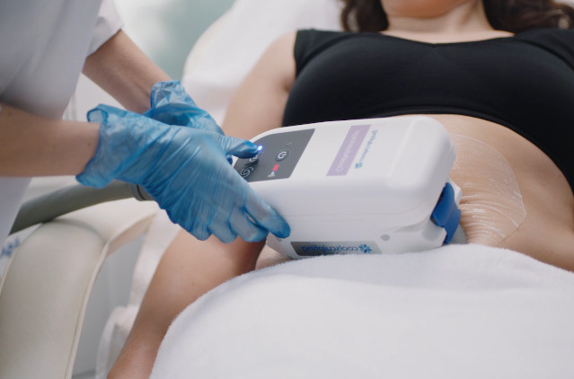 coolsculpt