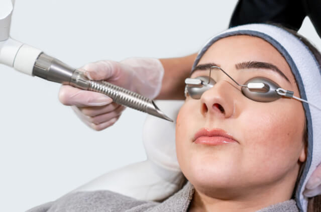 Q-switch-Laser Treatment