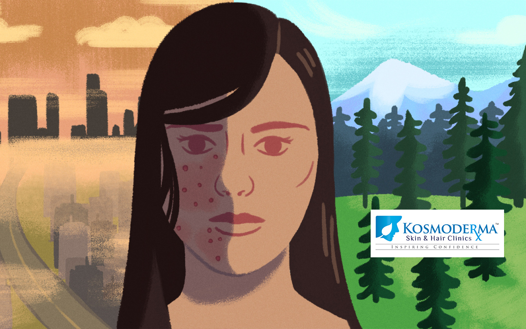Effects of Air Pollution on Your Skin | Kosmoderma
