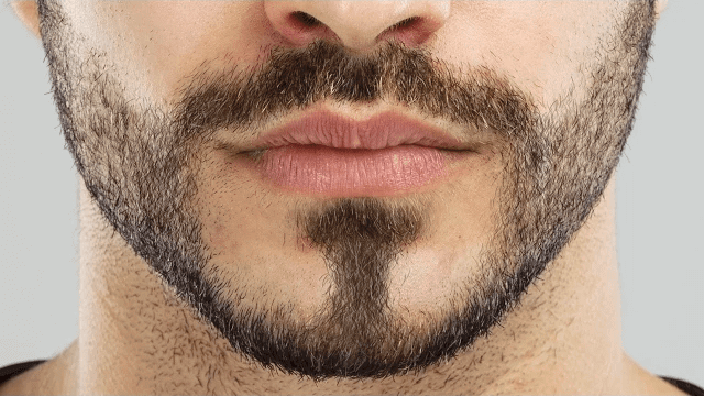 Beard Woes and the Easy Solution | Kosmoderma