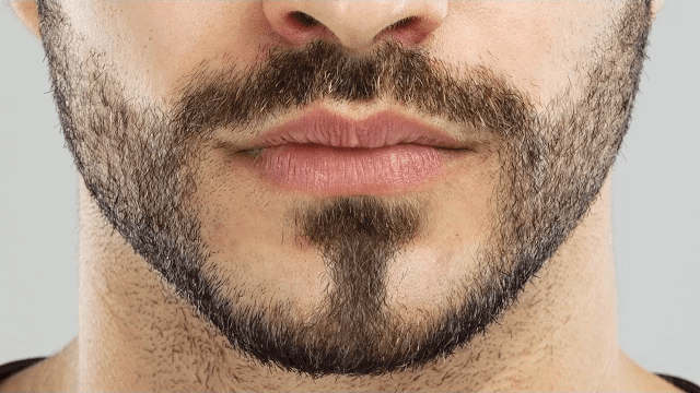 beard-woes-and-the-easy-solution
