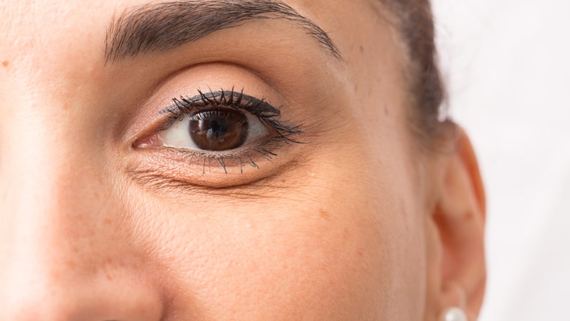 Eye Bag Surgery Costs Benefits Risks Recovery Time and More