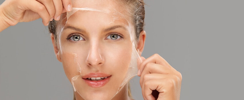 why-peels-and-not-peel-offs
