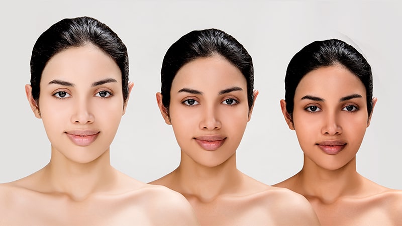 Kosmoderma Skin and Hair Clinic Bangalore