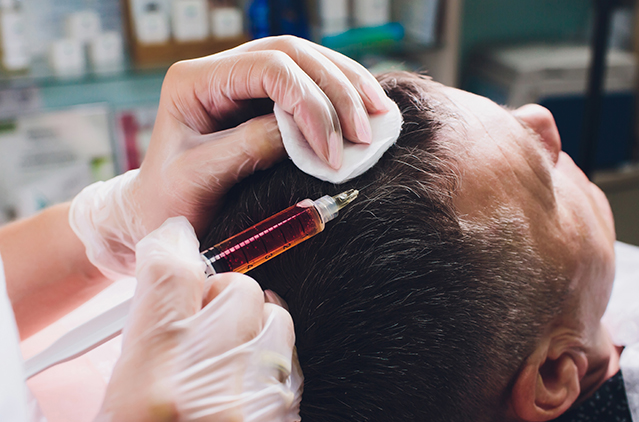 What’s New: Hair Fall Treatments In Chennai At Economical Costs Now! | Kosmoderma