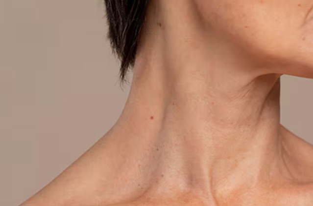 Ways to Get Rid of Neck Fat Fast in Chennai | Kosmoderma