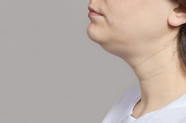 Love The Sculpted Look? Achieve A Well-defined Chin, Jawline, And Neckline With Double Chin Surgery! | Kosmoderma