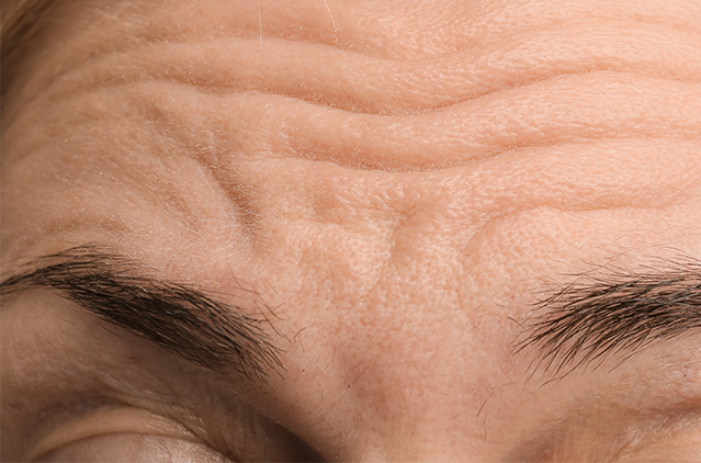 What’s the Best Treatment for Wrinkles? A Complete Guide to Smooth, Youthful Skin | Kosmoderma