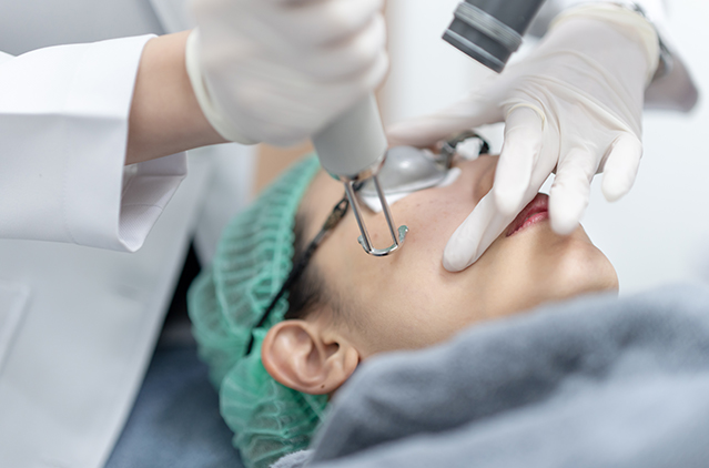 How Having Pico Laser Treatment Feels Like on Your Skin – A Firsthand Experience | Kosmoderma