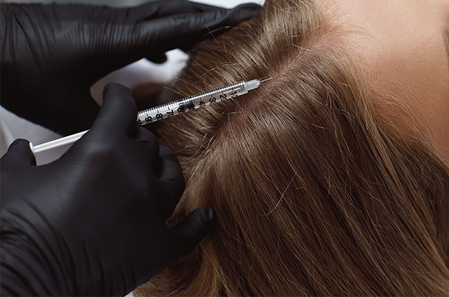 Exosome Therapy for Hair Loss: Does It Really Work? | Kosmoderma