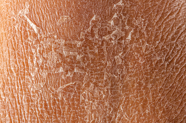 Say Hello To Soft, Smooth And Rejuvenated Skin | Kosmoderma