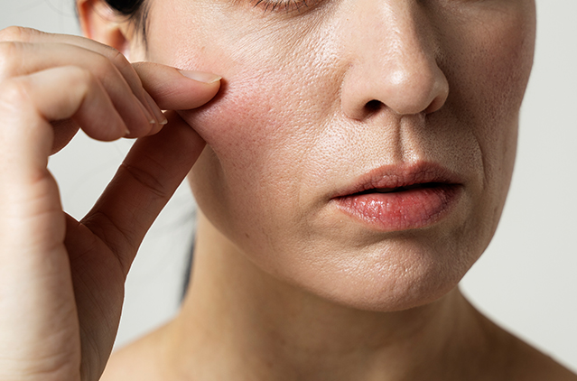 Preventing Premature Aging Is Now Possible With New, Advanced, Non-surgical Treatments! | Kosmoderma