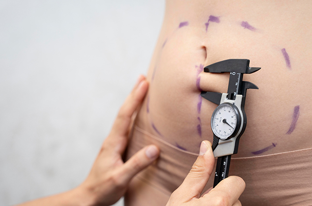 What’s Your Pick? Body Contouring Or Liposuction | Kosmoderma