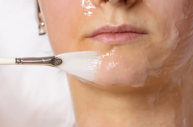 Busted: The Many Myths Surrounding Chemical Peels! | Kosmoderma