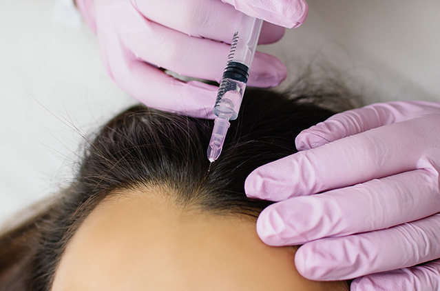 Have You Chosen The Best Clinic In Bangalore To Address Your Hair Loss Concerns? | Kosmoderma