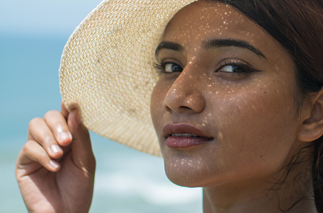 Listed: The Many Skin-linked Benefits Of Chemical Peels During Summertime! | Kosmoderma