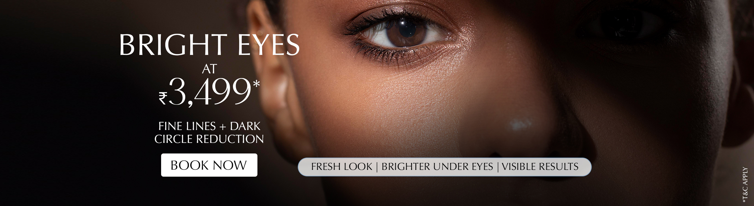 Bright Eyes WB