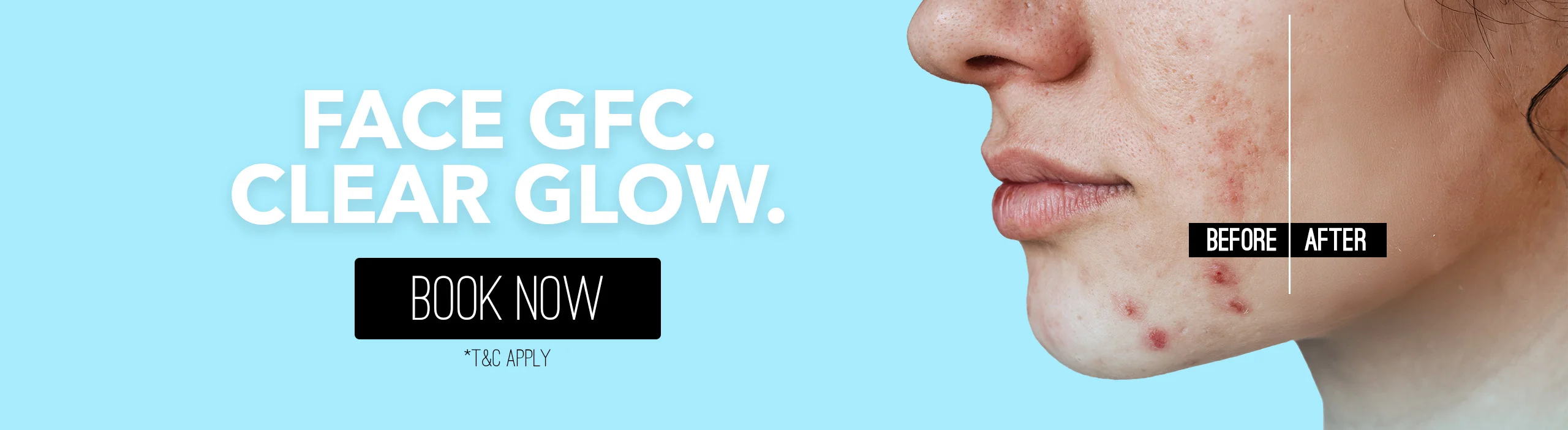 Pigmentation treatment in Bangalore