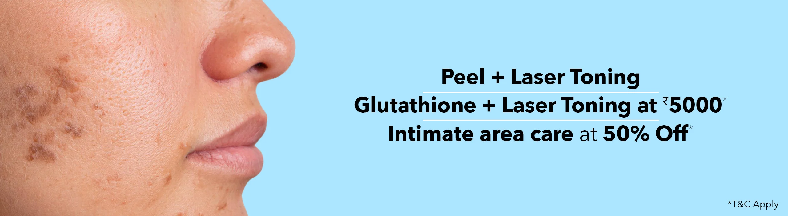 Chemical peel cost in bangalore