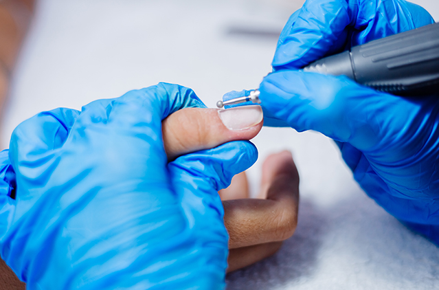 Nail Excision Treatment for Ingrown and Painful Nails