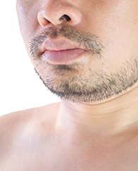 Double Chin & Jawline Corrections