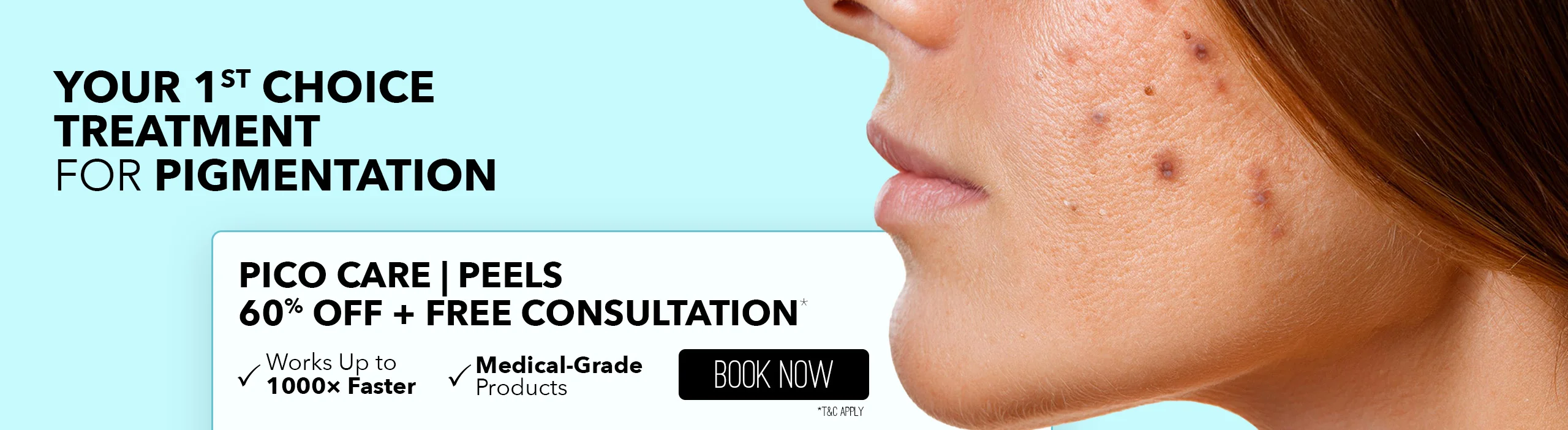 hyperpigmentaiton treatment