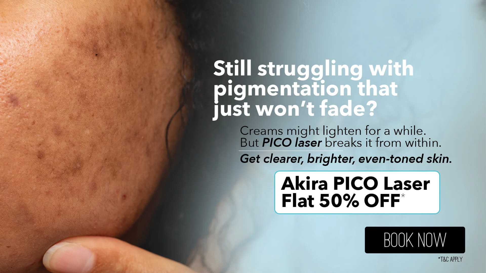 Akira PICO Laser WB