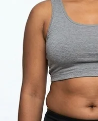 CoolSculpting for flanks and love handles for women.