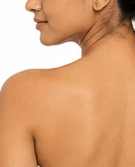 LHR for women neck and shoulder hair reduction treatment