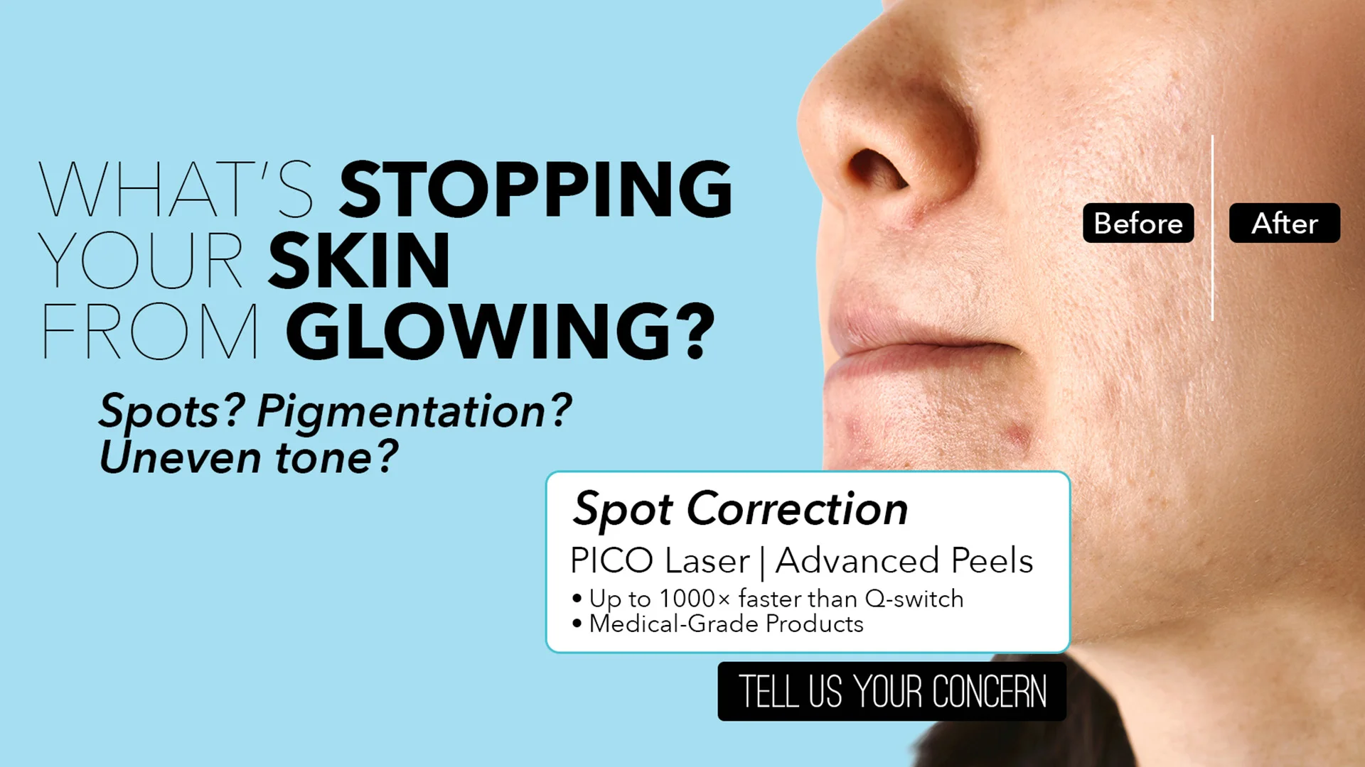 Spot Correction WB