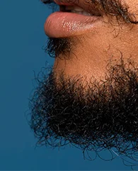 Beard shaping and neckline hair removal