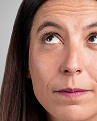 Carbon Laser Peel treatment for fine lines and wrinkles for women.