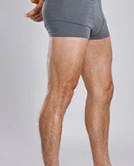 Full body laser hair removal
