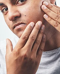Carbon Laser Peel treatment for dull skin for men.