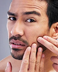 Exosome Therapy for dull skin