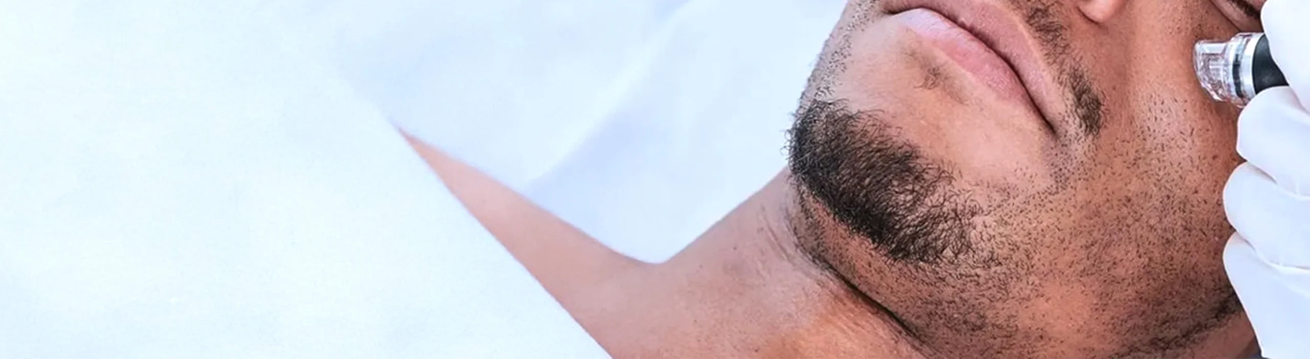 Hydrafacial Treatment at Kosmoderma for Male