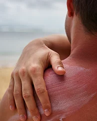Exosome Therapy for sun damage and tanning