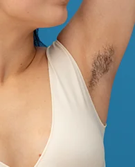 Underarms Hair Removal