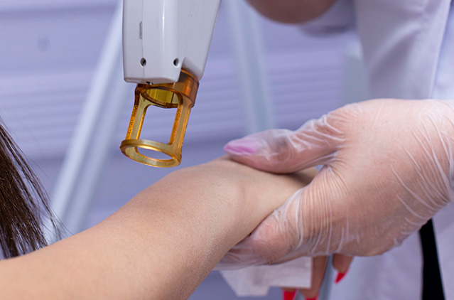 Benefits of Laser Treatment for Clear and Healthy Skin