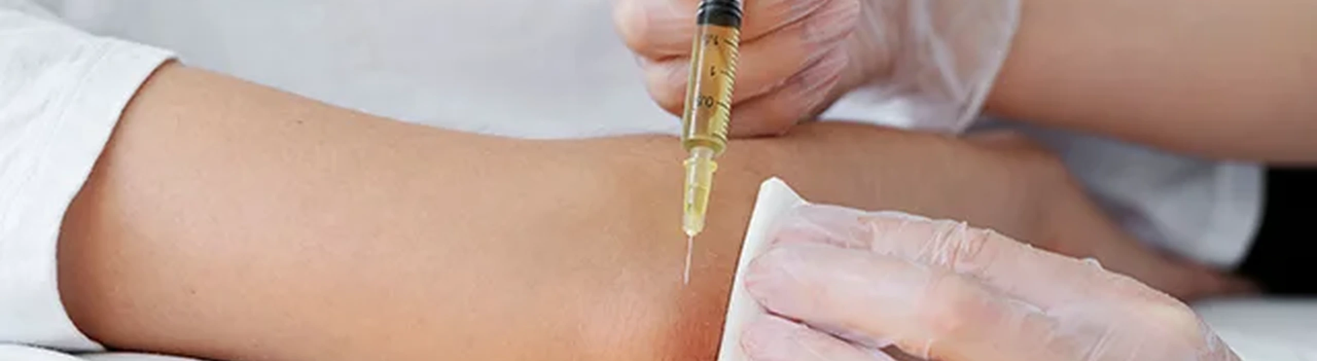 Glutathione IV Drip therapy for skin booster