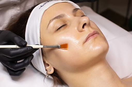 Step-by-Step Guide to Chemical Peel Procedure for Smooth, Glowing Skin