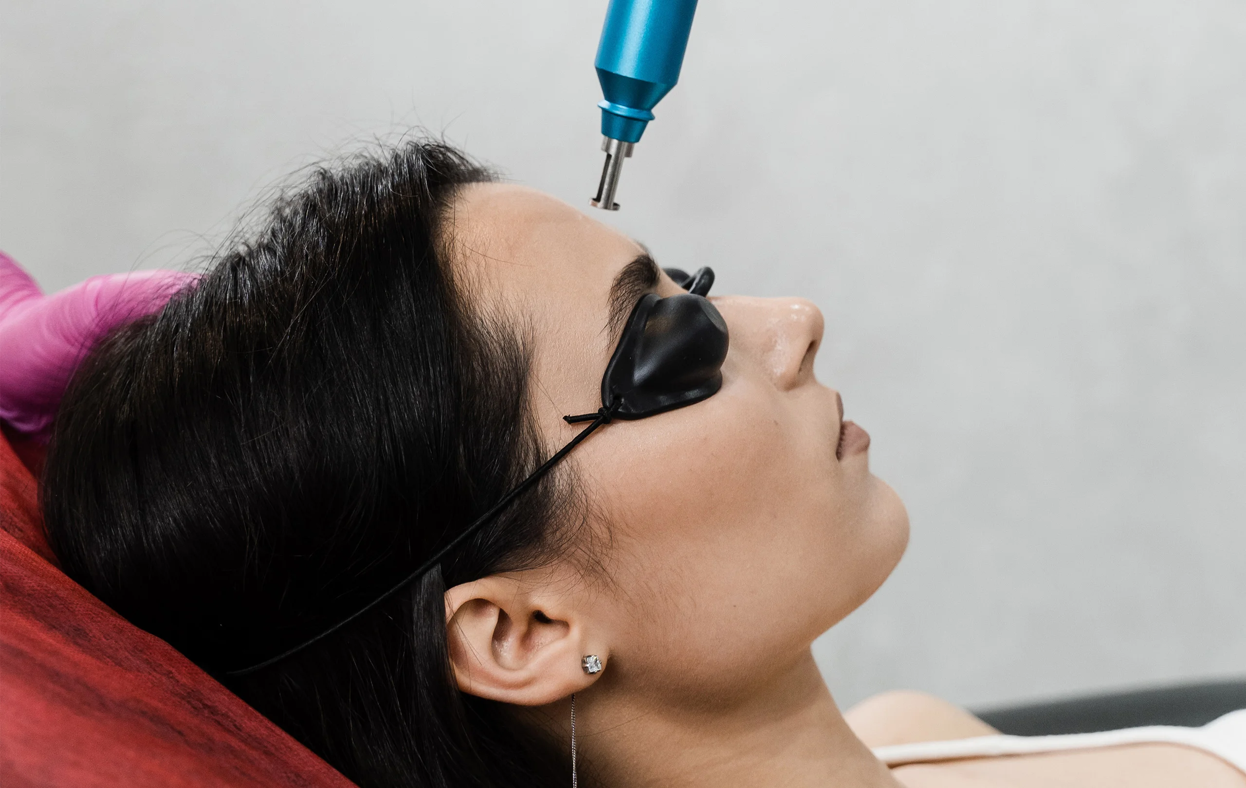 Glowing Skin Simplified: A Guide to the Different Types of Laser Treatments for Face